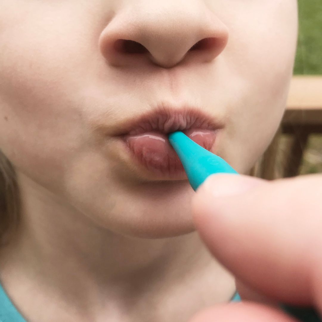 ARK's proButton™ Set for Lip Closure/Strength